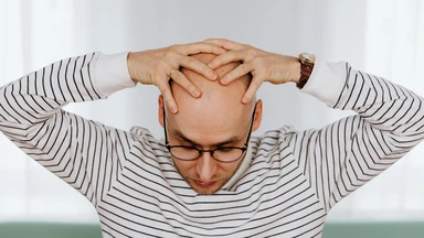 Hói có di truyền không và những yếu tố ảnh hưởng đến tóc?