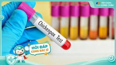 Bệnh thủy đậu có nguy hiểm không?