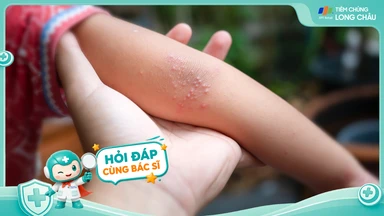 Cách phòng tránh bệnh tay chân miệng cho trẻ ở trường mầm non?