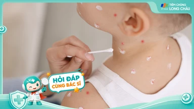 Phân biệt tay chân miệng và thủy đậu như thế nào?