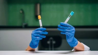 Kết quả đo độ mờ da gáy 1.1mm có cần làm Double test không?