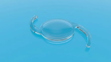 Mổ đục thủy tinh thể được mấy lần? Khi nào cần can thiệp?