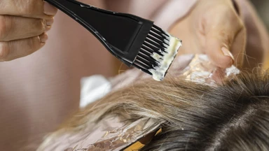 Nhuộm tóc bị rát da đầu: Nguyên nhân, cách xử lý và phòng tránh