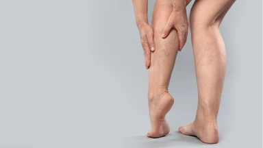 Nổi gân tím ở chân: Nguyên nhân, dấu hiệu và cách xử lý