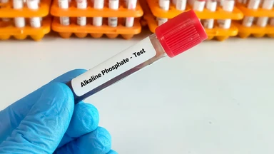 Phosphatase kiềm là gì? Chỉ số ALP cao hoặc thấp có ý nghĩa gì?