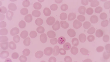 plasmodium_falciparum_la_gi_duong_lay_truyen_trieu_chung_va_cach_phong_ngua_1_017596eb50