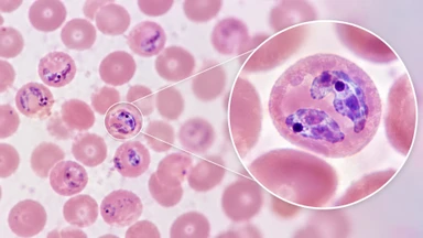 plasmodium_knowlesi_la_gi_trieu_chung_chan_doan_va_cach_phong_ngua_5_18f22f7bf3