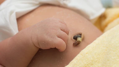 Quá trình rụng rốn ở trẻ sơ sinh và cách chăm sóc đúng cách