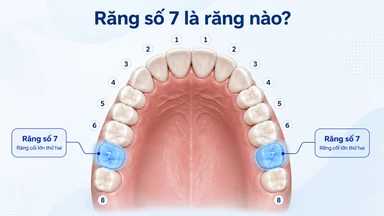 Răng số 7 là răng nào? Có thay không và khi nào nên nhổ?