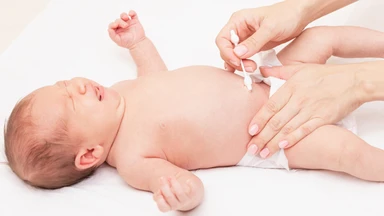 Rốn trẻ sơ sinh có mùi hôi: Nguyên nhân và cách chăm sóc rốn của trẻ trong giai đoạn này