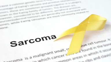 Sarcoma xơ bì lồi: Nhận biết dấu hiệu, nguyên nhân 