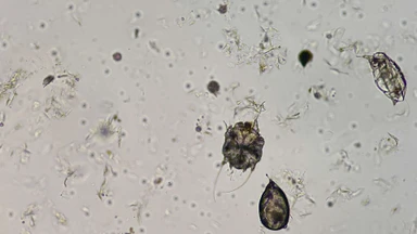 sarcoptes_scabiei_la_gi_trieu_chung_benh_ghe_va_cach_phong_ngua_lay_nhiem_4_6423a7a245