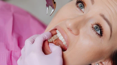 Sau khi nhổ răng khôn nên làm gì để nhanh hồi phục?