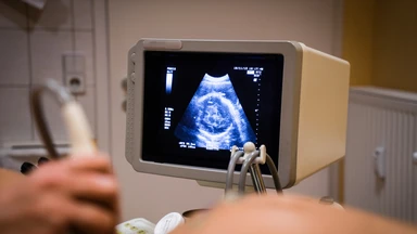Siêu âm thai 10 tuần: Những điều mẹ bầu cần biết