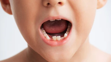 Mất răng lâu ngày có thể ảnh hưởng đến khả năng ăn nhai và sức khỏe răng miệng