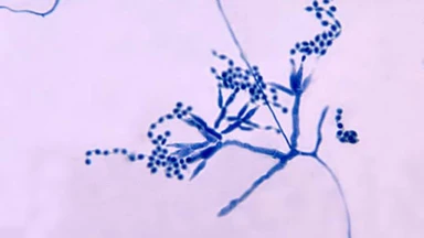 talaromyces_marneffei_la_gi_va_cach_nhan_biet_benh_nhiem_nam_0_6d5729d825