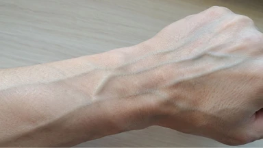 Tay nổi gân xanh do đâu? Vị trí thường xuất hiện gân xanh