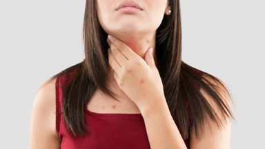 Thủy đậu gây đau họng không? Nguyên nhân, cách xử trí