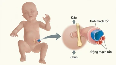 Tĩnh mạch rốn là gì? Những bất thường có thể gặp phải