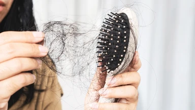 Tóc rụng không mọc lại: Nguyên nhân và cách phòng ngừa