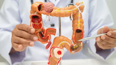 Tổn thương Dieulafoy là gì? Vị trí thường xuất hiện tổn thương?