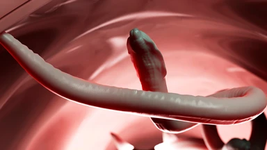 Toxocara cati là gì? Nguyên nhân, triệu chứng và cách phòng ngừa giun đũa mèo 