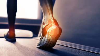Viêm gân Achilles là gì? Nguyên nhân, triệu chứng và biện pháp điều trị hiệu quả