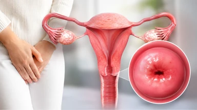 Viêm lộ tuyến tử cung có lây không? Cách phòng ngừa hiệu quả