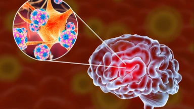 Viêm não do ve truyền: Nguyên nhân, điều trị và cách phòng ngừa