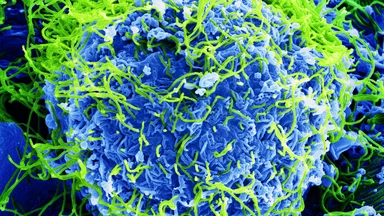 Virus Ebola có nguy hiểm không?
