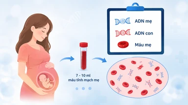 Xét nghiệm ADN thai nhi không xâm lấn là gì? Quy trình, độ chính xác và những điều cần biết