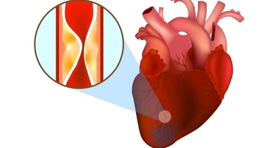 Xét nghiệm CK-MB là gì? Ý nghĩa chỉ số CK-MB trong chẩn đoán tim mạch