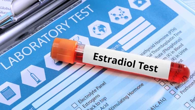 Xét nghiệm định lượng Estradiol là gì? Mục đích và lưu ý cần biết
