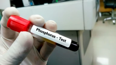 xet_nghiem_dinh_luong_phospho_y_nghia_va_chi_so_binh_thuong_1_f1a77a7a0f