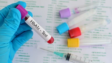 Xét nghiệm HbA1c cần nhịn ăn không? Cách chuẩn bị và đọc kết quả