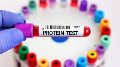 Xét nghiệm protein toàn phần có ý nghĩa gì với sức khỏe?