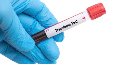 Xét nghiệm Transferrin là gì? Ý nghĩa của xét nghiệm Transferrin trong chẩn đoán