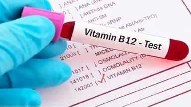 Xét nghiệm vitamin B12 là gì? Khi nào cần thực hiện?
