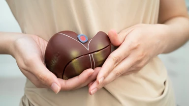 Xơ gan F4 là gì? Mức độ nguy hiểm, triệu chứng và hướng điều trị