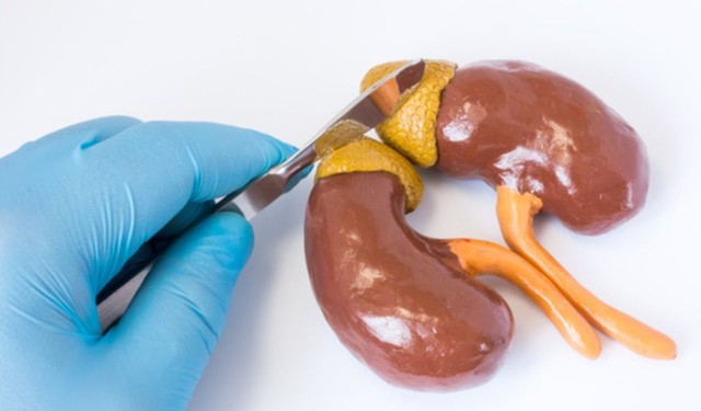 Sau mổ u tuyến thượng thận có biến chứng gì và cách chăm sóc thế nào?