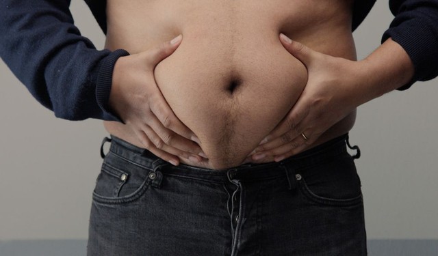 Giảm mỡ bụng dưới cho nam như thế nào? Nguyên nhân gây tích mỡ bụng