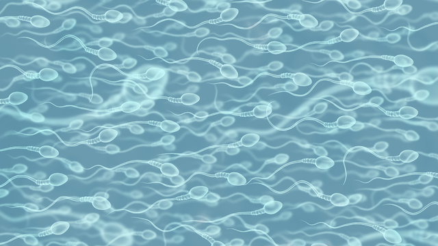 Kết quả tinh dịch đồ là gì? Các yếu tố ảnh hưởng đến kết quả