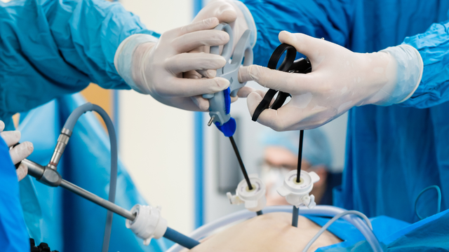 Mổ nội soi là gì? Những rủi ro và hạn chế có thể gặp khi mổ nội soi