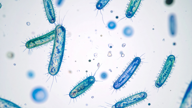 Cách đọc kết quả xét nghiệm vi khuẩn nhuộm soi và ý nghĩa các chỉ số