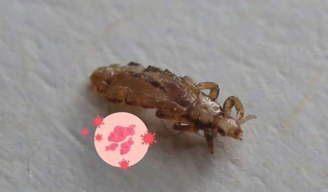 Rận mu có tự hết không? Những ảnh hưởng nếu không điều trị kịp thời