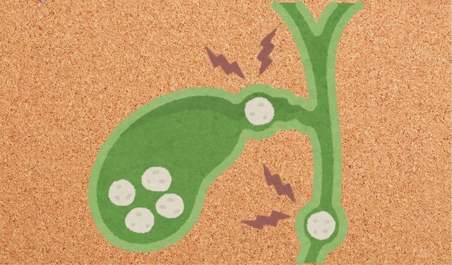 Người mổ sỏi mật nên ăn trái cây gì để hỗ trợ phục hồi tiêu hóa?