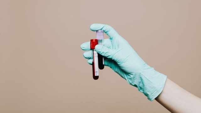 Trẻ mấy tháng cần xét nghiệm viêm gan B? Các xét nghiệm cần thực hiện