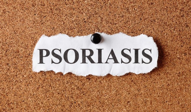 Vảy nến thể giọt là gì? Nguyên nhân, triệu chứng và cách điều trị