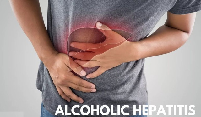 Viêm gan do rượu là gì và có các phương pháp điều trị nào?