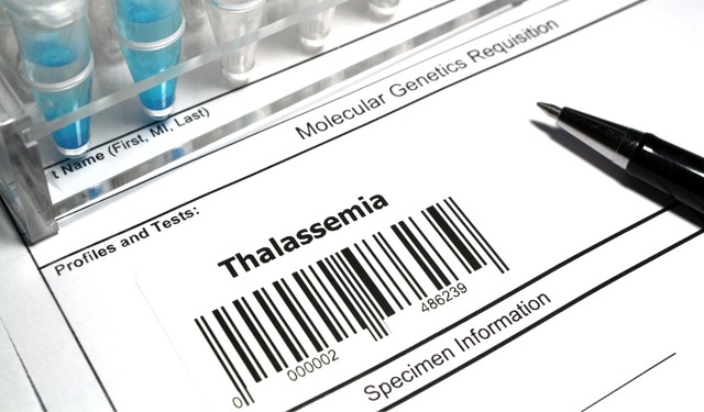 Xét nghiệm gen thalassemia là gì? Đối tượng nào nên xét nghiệm?